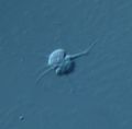Amöbe? 400x, 12my - Fokalebene 1 (9394251411).jpg
