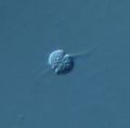 Amöbe? 400x, 12my - Fokalebene 1 (9394252413).jpg