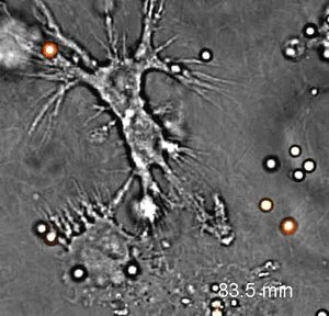 File:S8-Dendritic Cells Dragging Conidia in Collagen.ogv